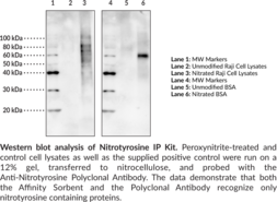 Nitrotyrosine IP Kit