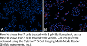 Lysosomal Staining Kit (Red Fluorescence)