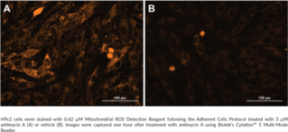 Mitochondrial ROS Detection Assay Kit